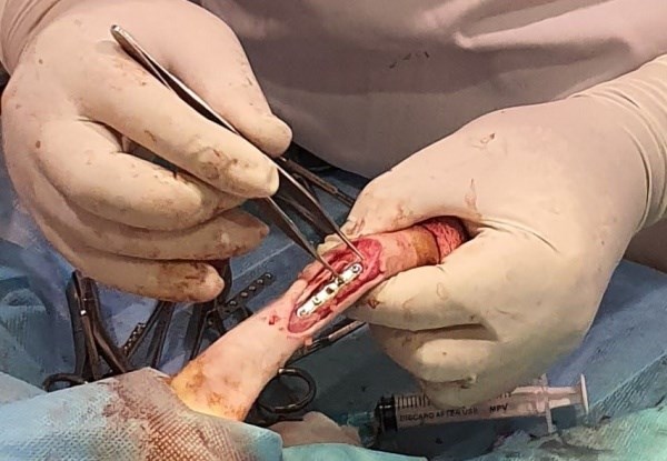 Phẫu thuật đóng đinh với ca bệnh gãy xương chân ở chó (2019)