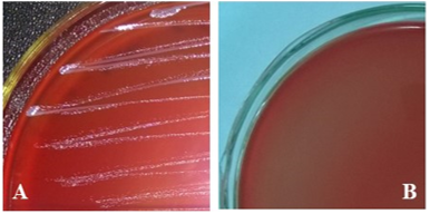 Phân lập và xác định khả năng mẫn cảm với kháng sinh của vi khuẩn gây bệnh bại huyết trên vịt (Riemerella anatipestifer) tại huyện Nam Trực, tỉnh Nam Định