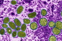Bác sỹ thú y Những điều cần biết về bệnh đậu mùa khỉ - Veterinarian What to know about Monkeypox