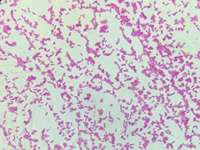 Tỷ lệ nhiễm, khả năng kháng kháng sinh và đặc tính sinh học phân tử của vi khuẩn Escherichia coli sản sinh men Extended Spectrum β - Lactamases ESBLs phân lập từ thịt