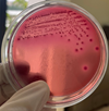 Phân lập và khảo sát một số đặc điểm sinh học của vi khuẩn Avian pathogenic Escherichia coli APEC ở gà nuôi tại Hà Nội