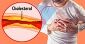 4 loại thực phẩm tốt nhất giúp giảm mức cholesterol