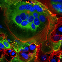 [VIROLOGY] Tại sao biến thể Delta lại nguy hiểm như vậy 2 3  HOẠT ĐỘNG NỘI BÀO