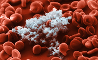 [VACCINE DEVELOPMENT] Vaccine COVID-19 và hiện tượng gây đông máu - các nghiên cứu đến nay đã giải thích được những gì
