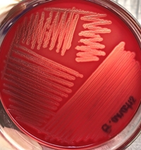 Gallibacterium anatis – Mần bệnh mới nổi trên gia cầm tại Việt Nam