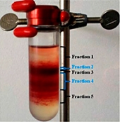 Phosphatidylserine Exposure in Human Red Blood Cells Depending on Cell Age