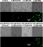 Novel Insights in the Regulation of Phosphatidylserine Exposure in Human Red Blood Cells